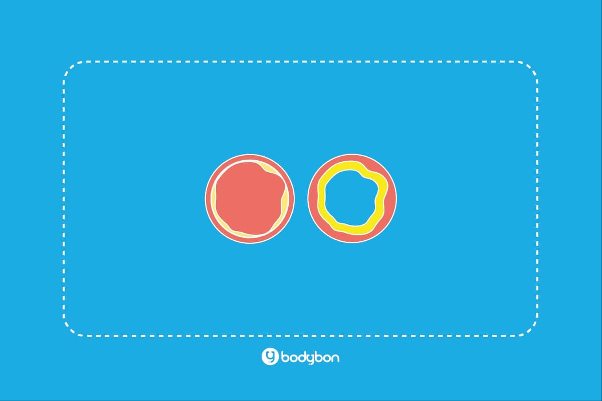 آزمایش کلسترول چیست؟ | تفسیر کلسترول در آزمایش خون