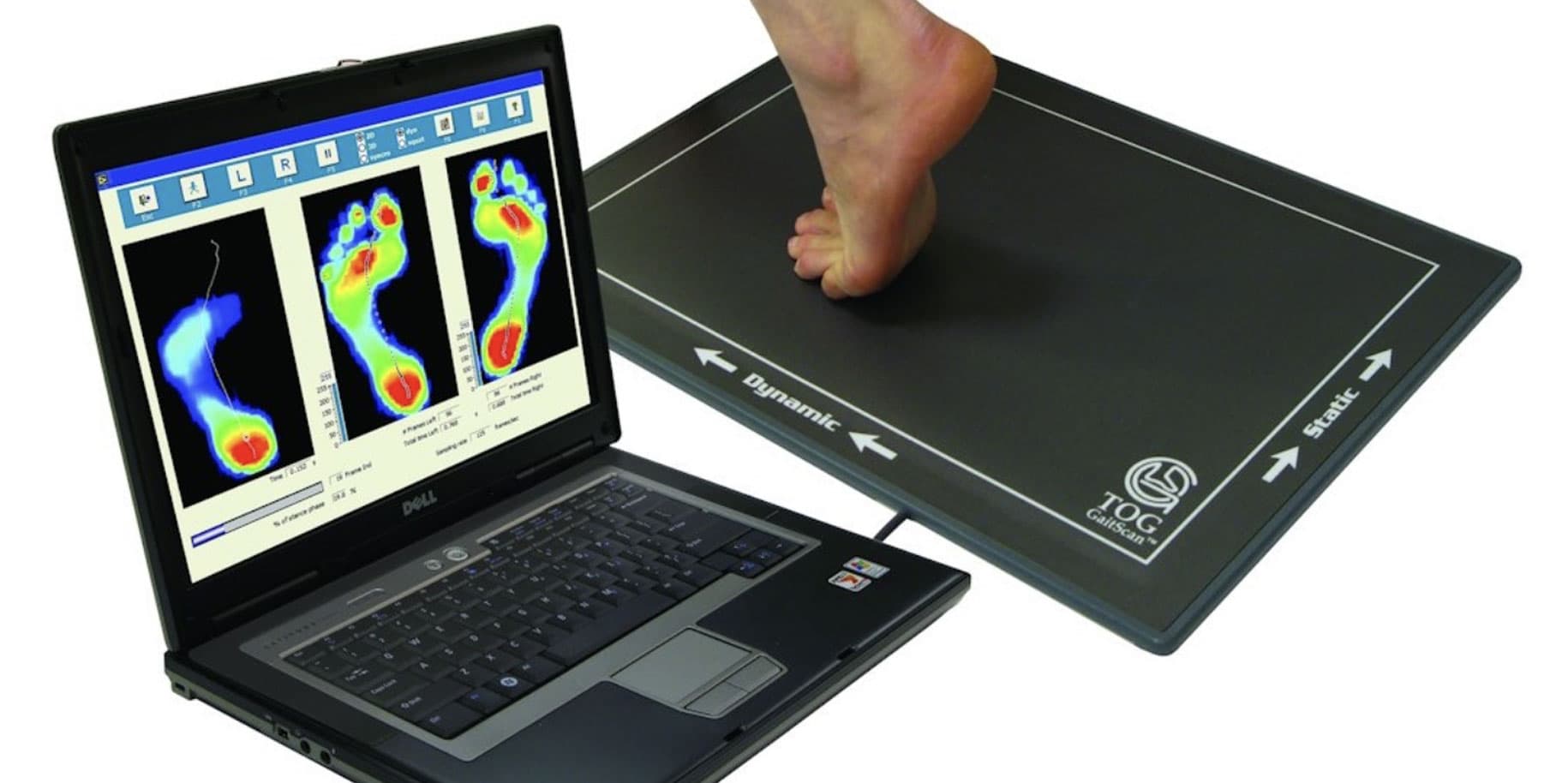 تحلیل فشار های کف پا