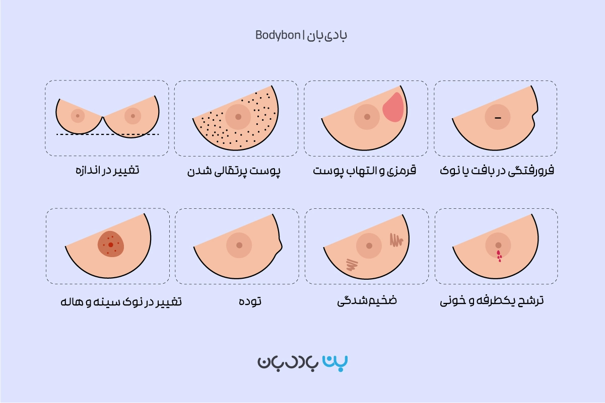 مهم‌ترین علائم سرطان سینه یا سرطان پستان