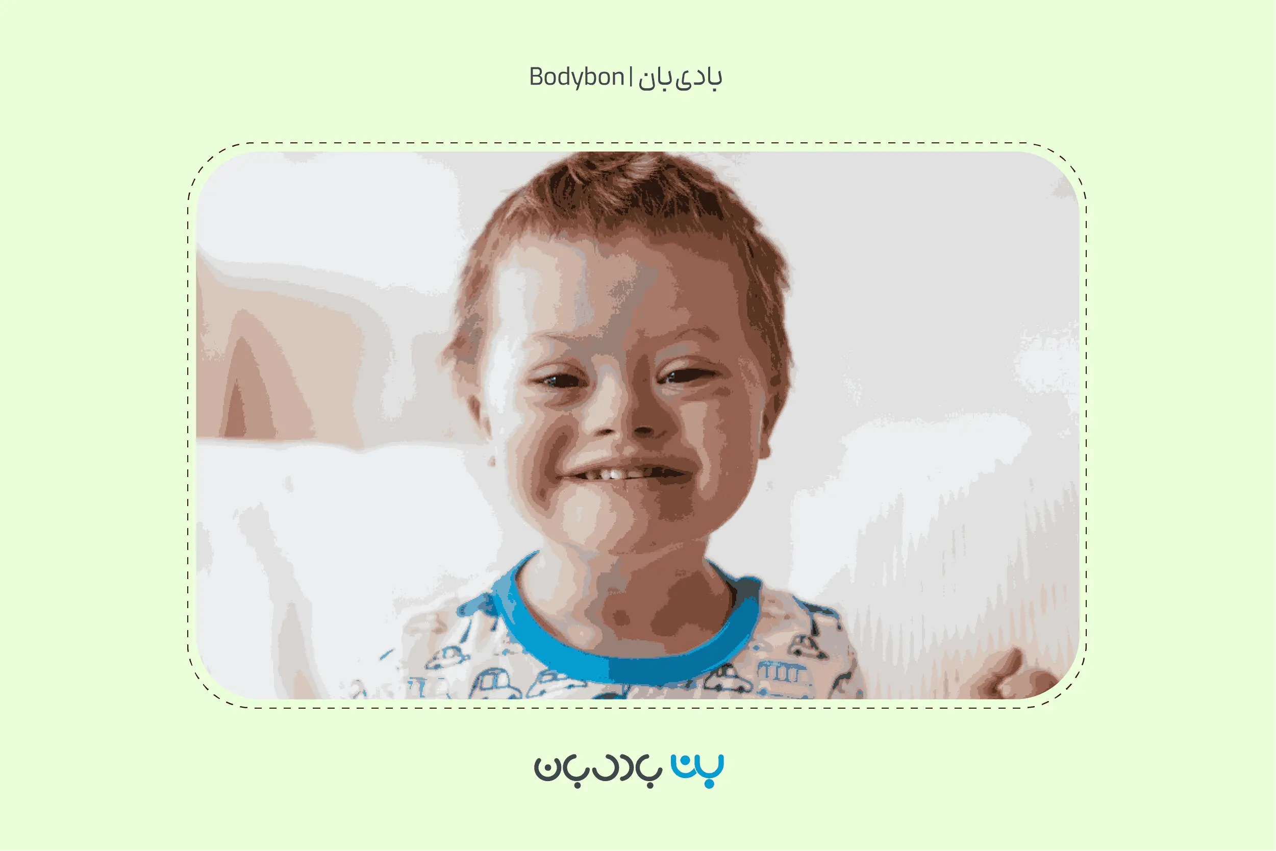 علائم نوزاد سندروم داون معمولا از بدو تولد در بدن نوزاد ظاهر می‌شود.
