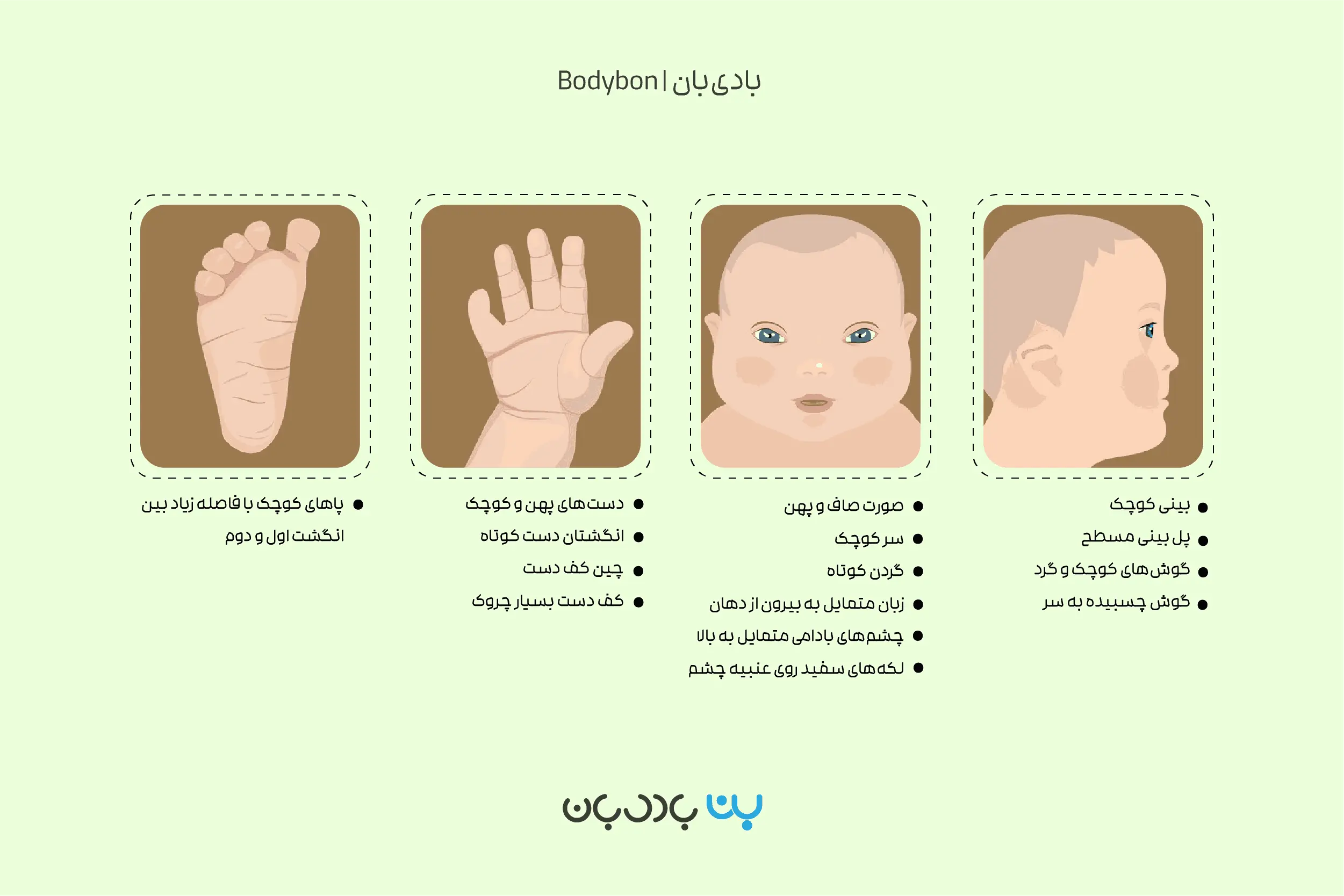 اینفوگرافیک علائم نوزاد سندروم داون (علائم فیزیکی)