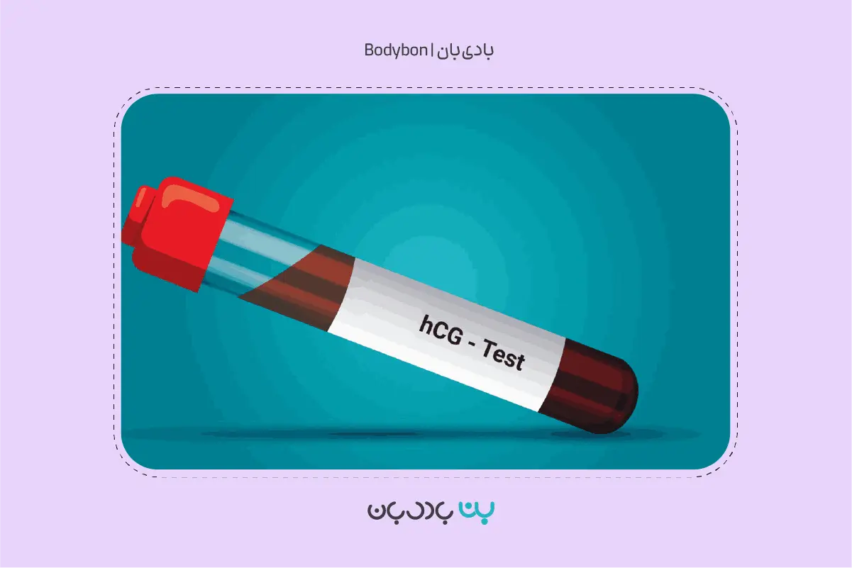 استفاده از مارکر هورمون hCG در آزمایش دابل مارکر