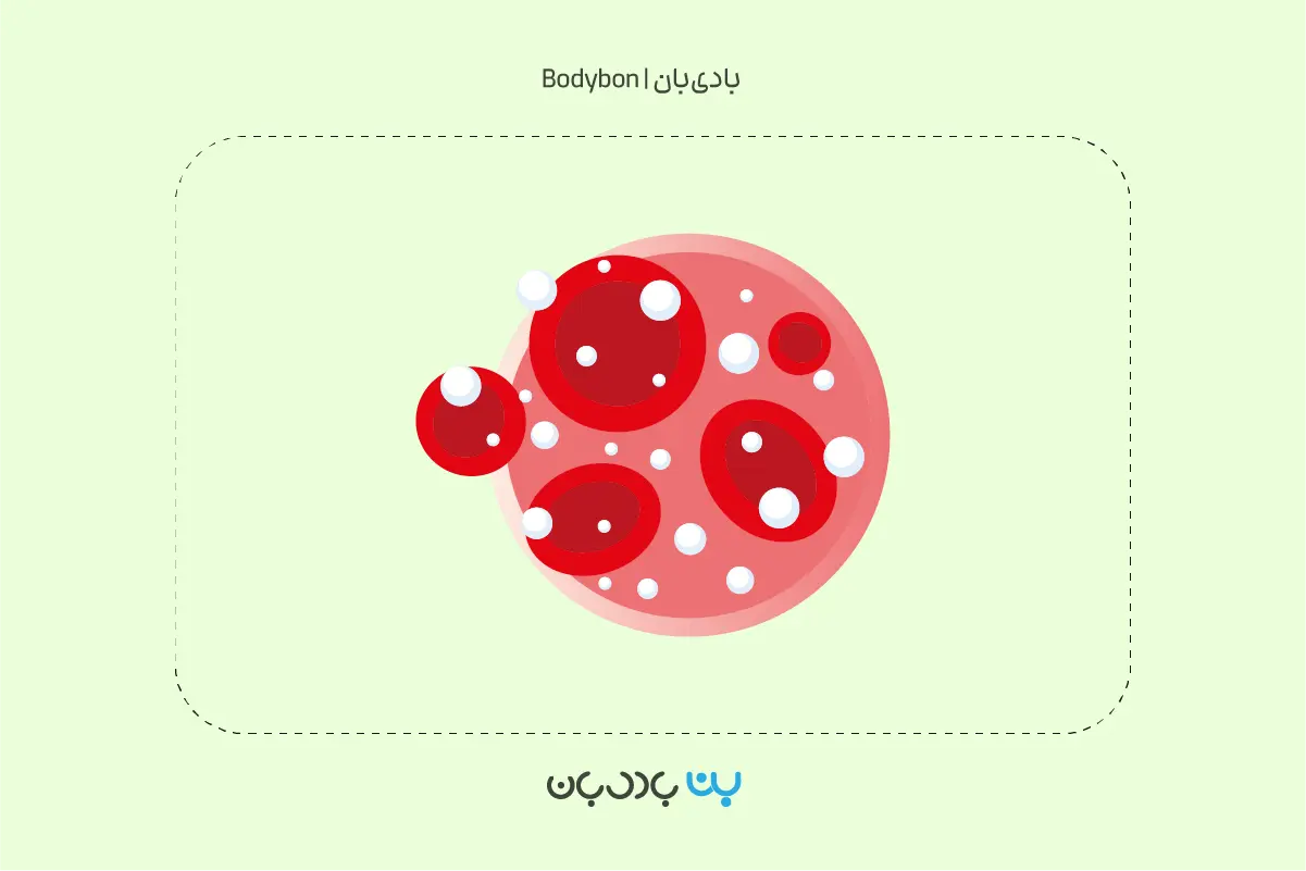 قند خون نرمال در تفسیر آزمایش قند خون ناشتا چقدر است؟ قند خون کمتر از ۱۰۰ نشان‌دهنده قند خون طبیعی است.