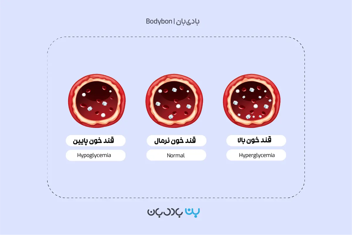 قند خون بالای 126 mg/dl در تفسیر آزمایش قند خون ناشتا نشانه قند خون بالا یا هایپرگلوسمی است.
