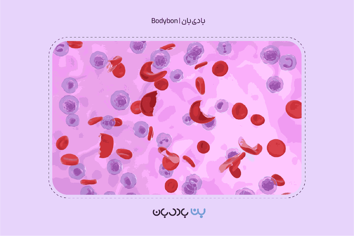کم خونی یا آنمی یکی از اختلالات خونی متداول است.