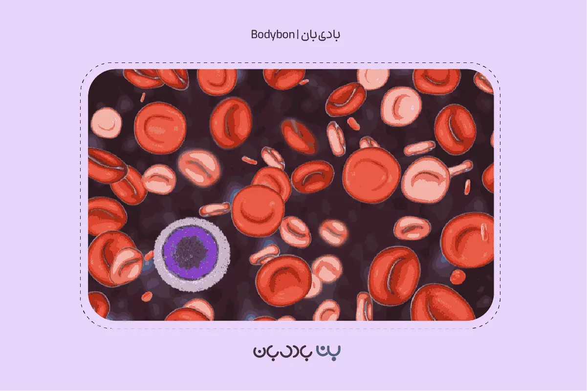 iron deficiency anemia 2 1