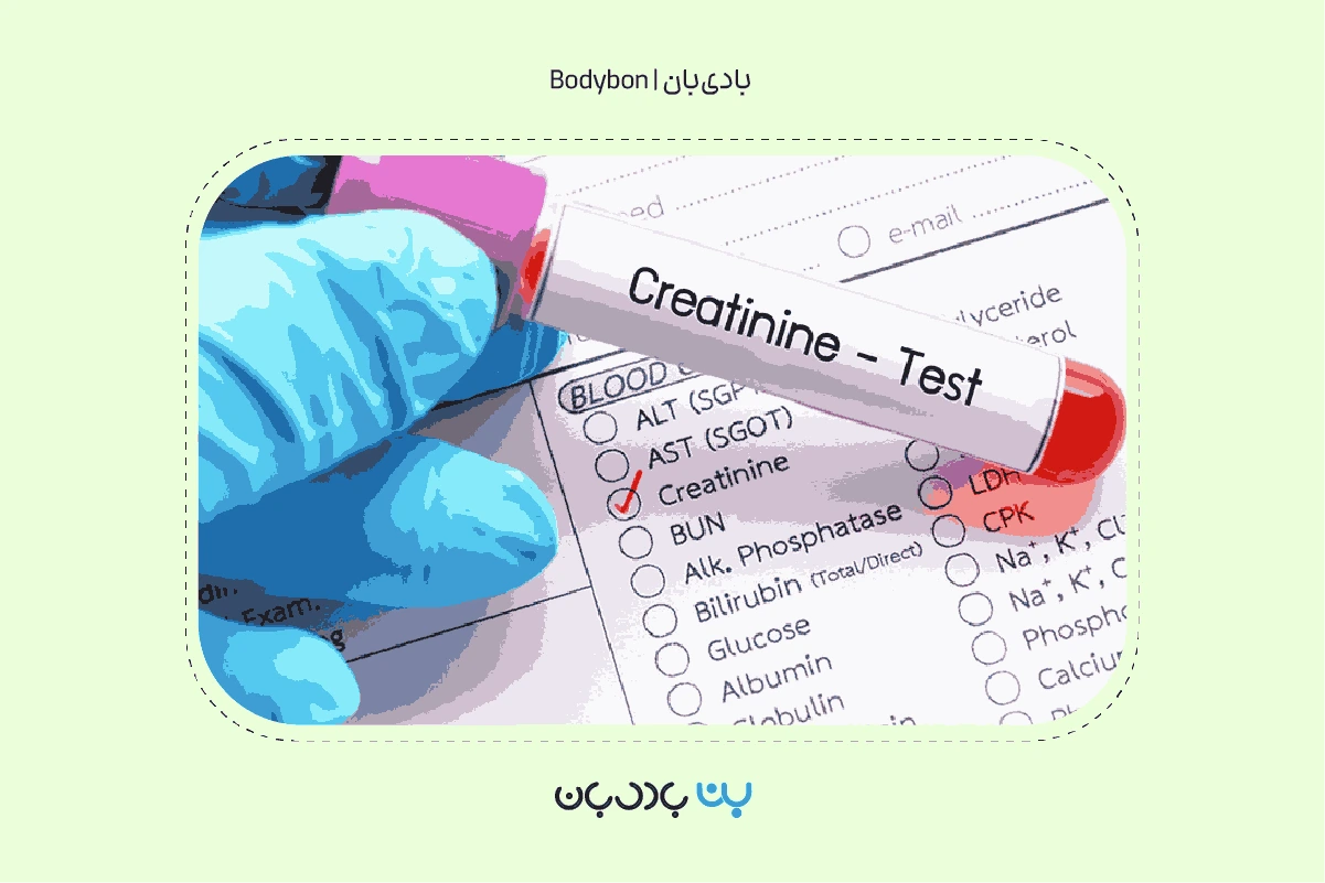 نحوه انجام آزمایش کراتینین خون و آمادگی آزمایش کراتینین خون چگونه است؟