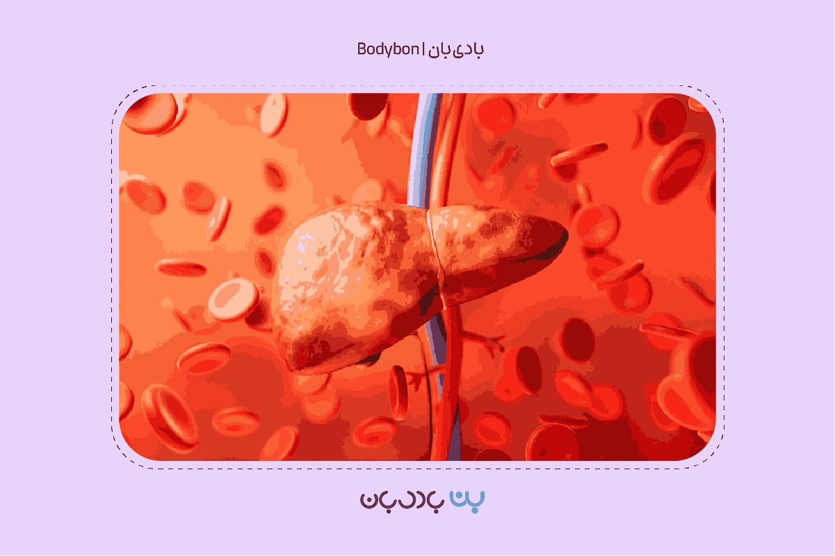 انجام آزمایش کبد چرب گامی اساسی برای پیشگیری از بیماری کبد چرب است.