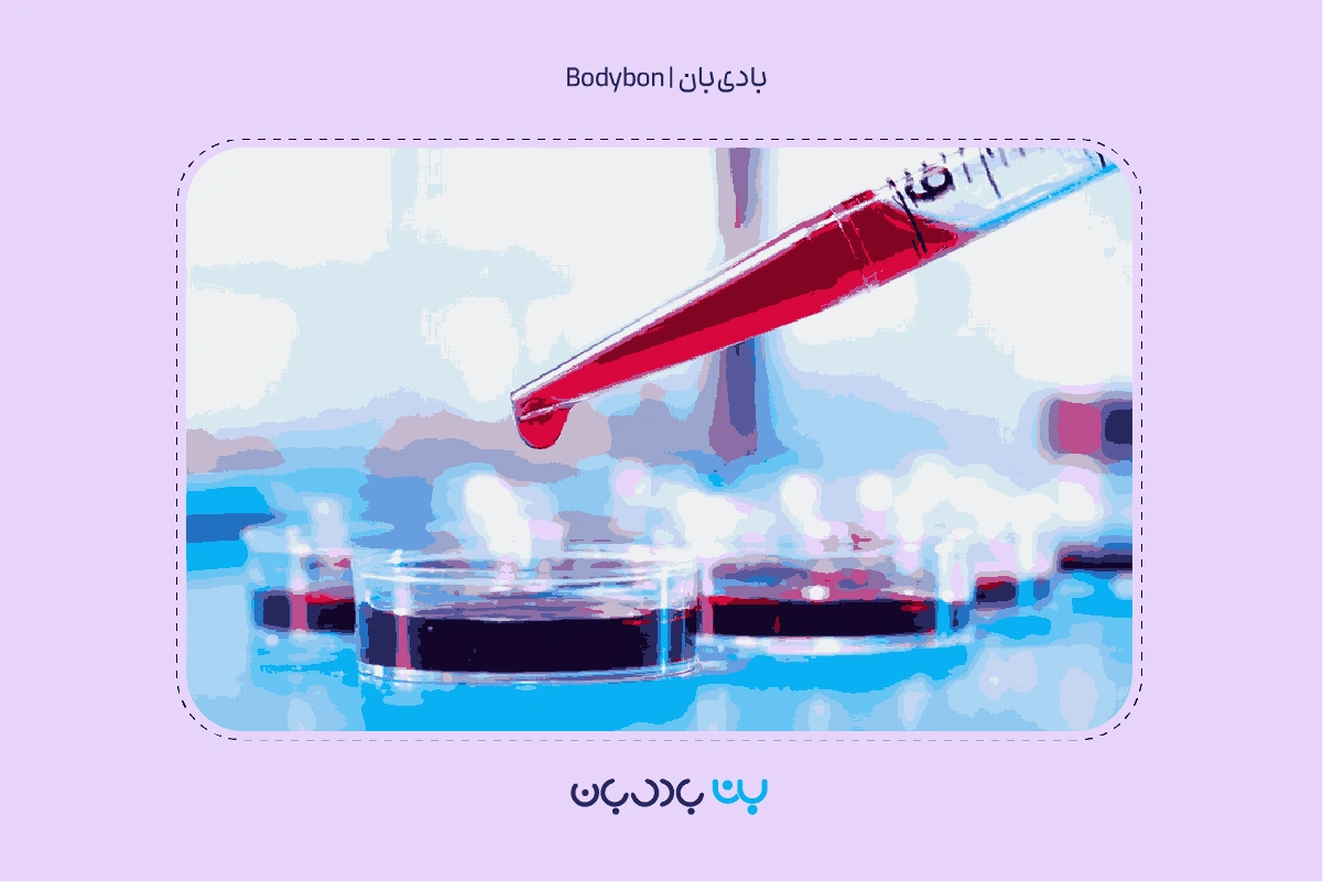 آزمایش Platelets چیست؟ PLT در آزمایش خون 1 what is platelets test 2