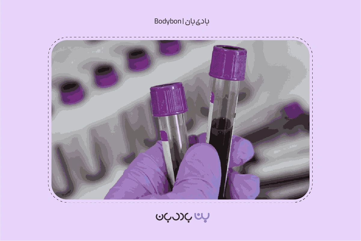 آزمایش Platelets چیست؟ PLT در آزمایش خون 3 what is platelets test 3
