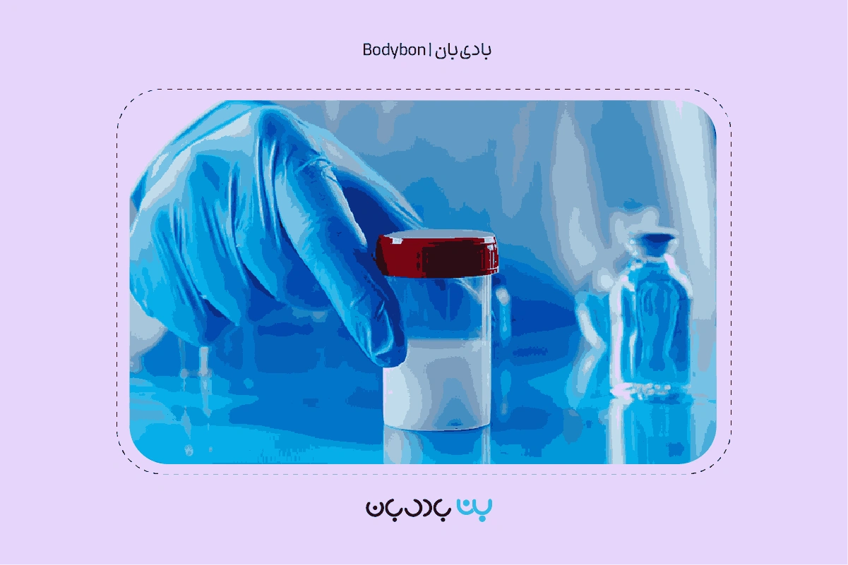 what is semen analysis 2