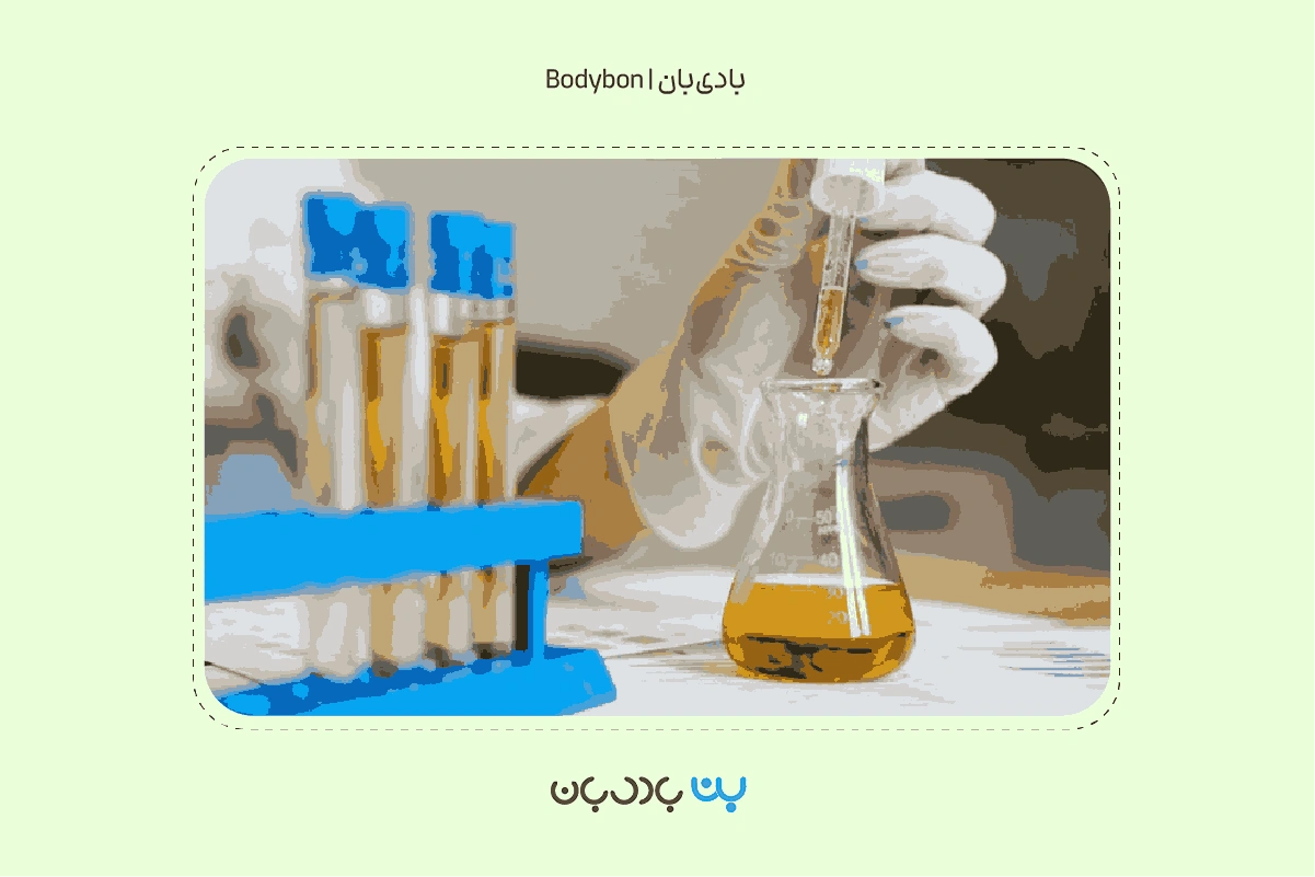تعیین نوع دقیق عفونت و قارچ در آزمایش کشت ادرار یا آزمایش urine culture