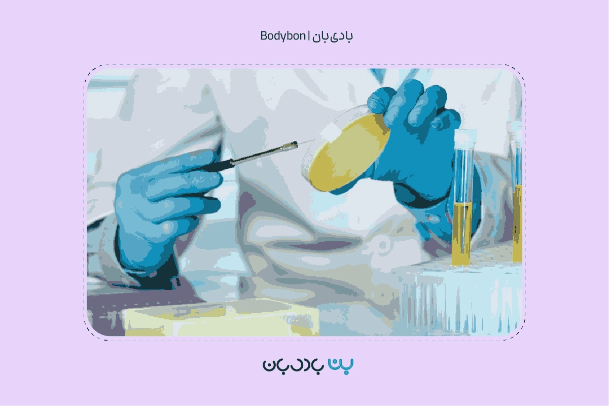 قرارگیری نمونه آزمایش ادرار در محیط کشت برای بررسی امکان یا عدم امکان رشد باکتری یا قارچ 