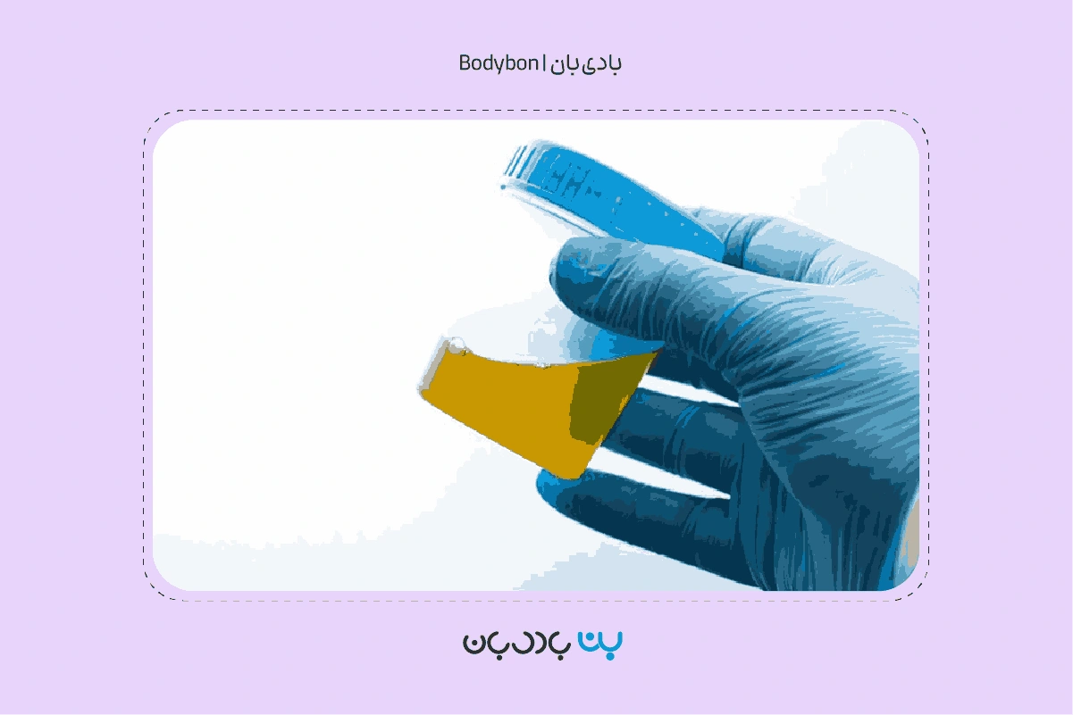 اهمیت بالای آزمایش کشت ادرار در دوران بارداری