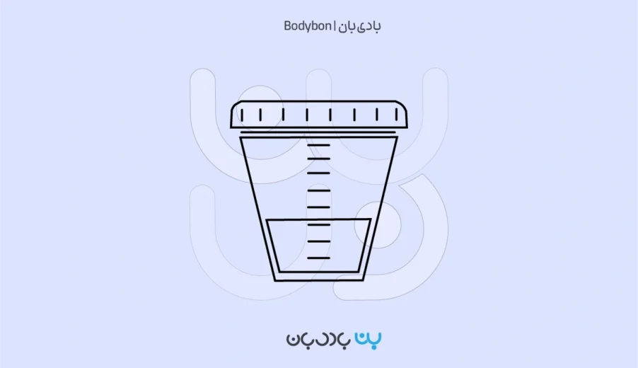 آزمایش کشت ادرار چیست؟ مراحل، روش‌ها و تفسیر نتایج