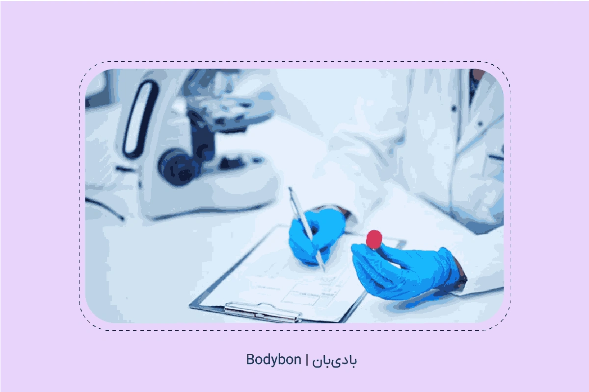 محدوده طبیعی AST در آزمایش خون یا آزمایش AST بسته به سن و جنسیت متفاوت است.