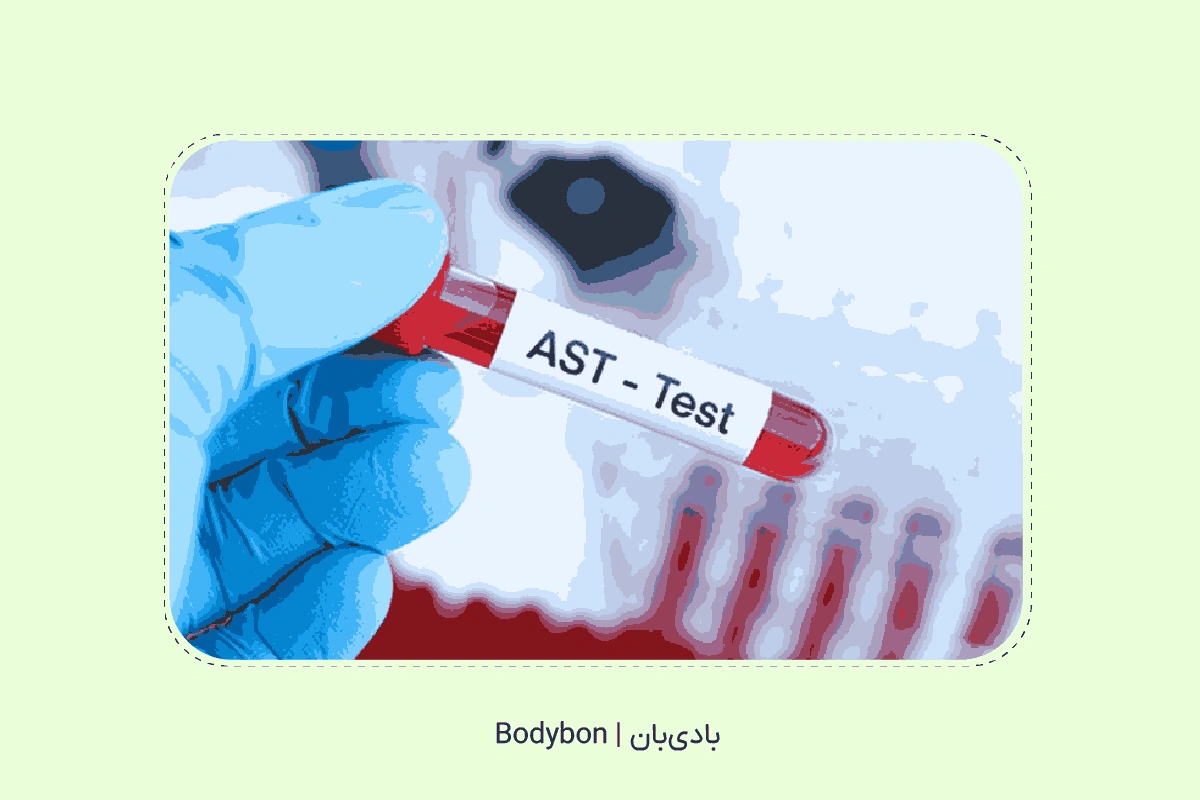 AST در آزمایش خون برای بررسی وضعیت کبد است.