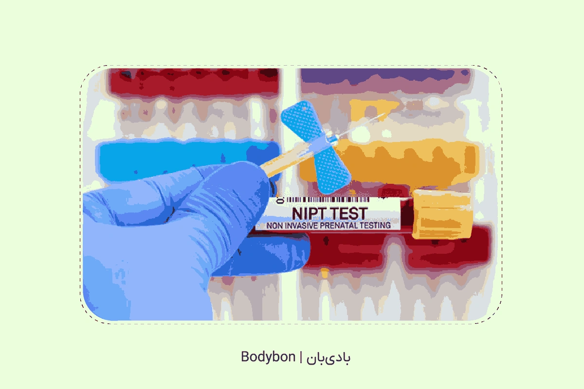 تفسیر آزمایش NIPT در قالب نتیجه منفی یا مثبت اعلام می‌شود.