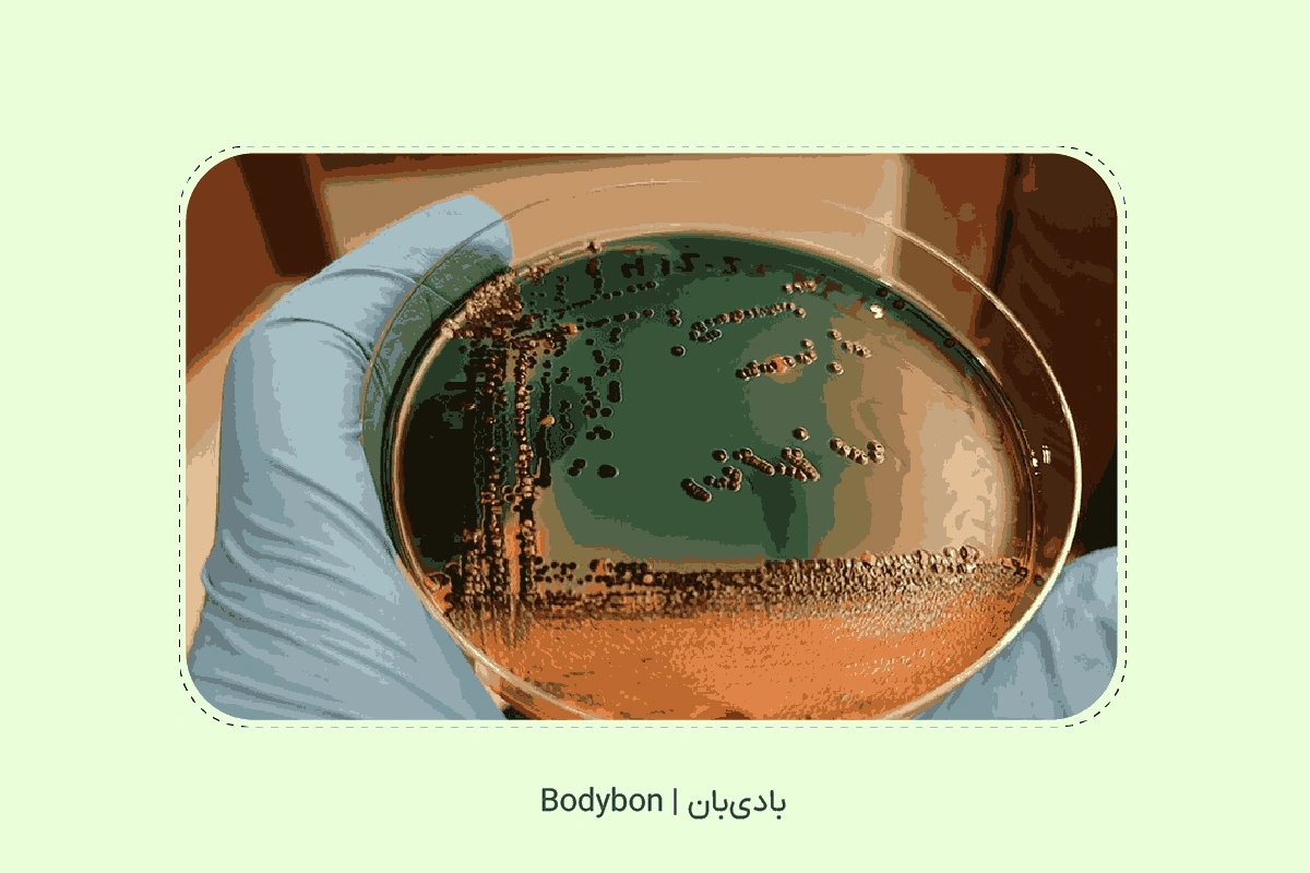 what is stool culture test 2