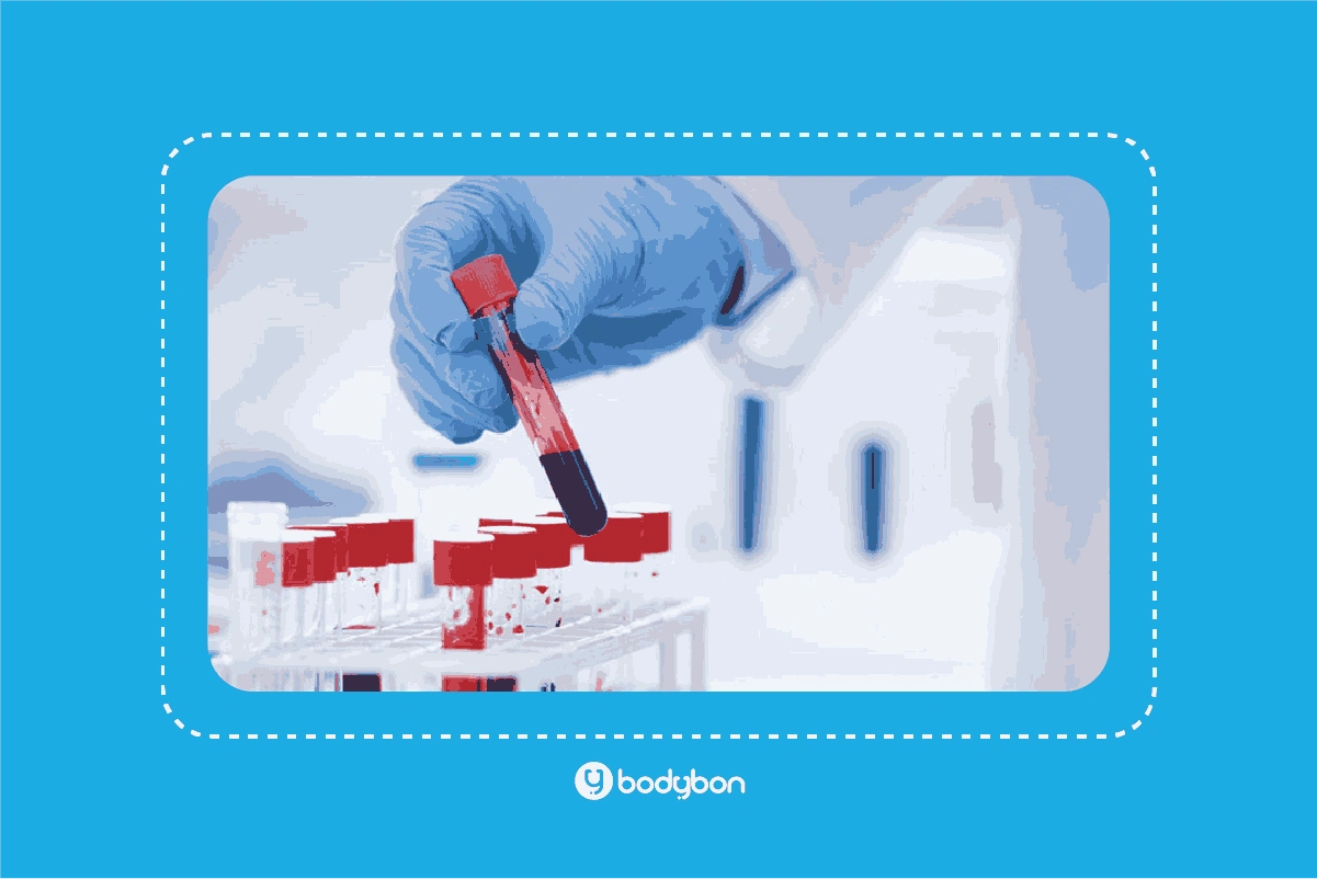 آزمایش کراتین خون؛ بررسی عملکرد عضلات و متابولیسم بدن 1 what is creatine in blood test 1