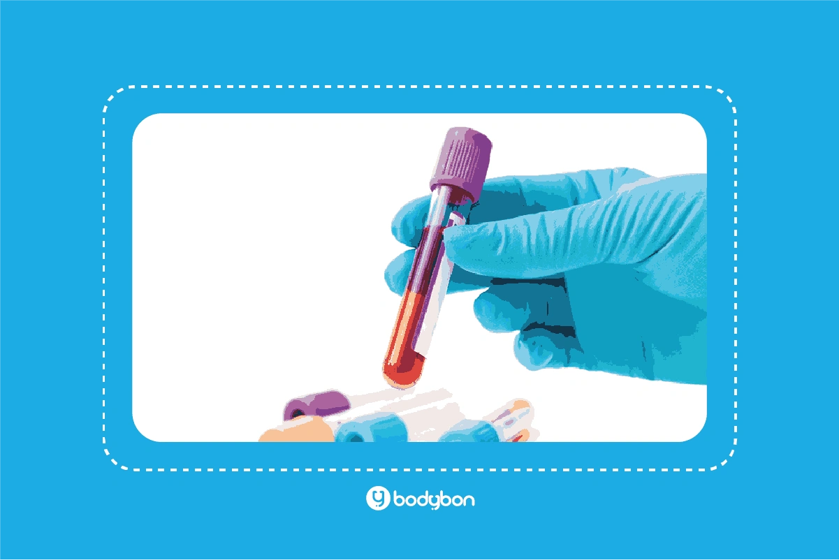 آزمایش کراتین خون؛ بررسی عملکرد عضلات و متابولیسم بدن 3 what is creatine in blood test 2