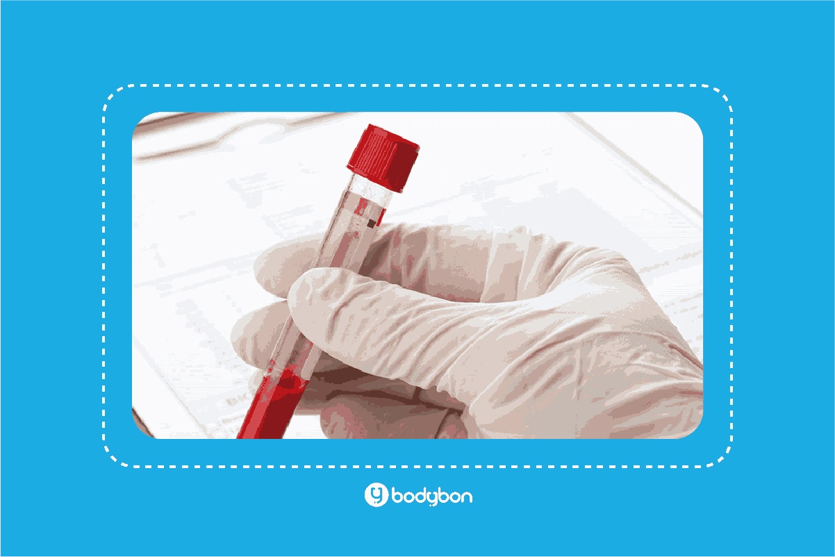 آزمایش کراتین خون؛ بررسی عملکرد عضلات و متابولیسم بدن 2 what is creatine in blood test 3