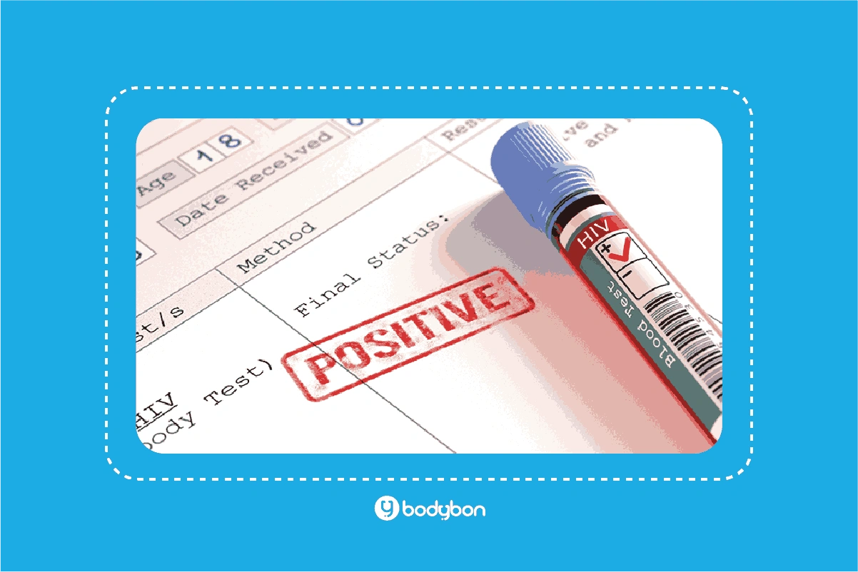 آزمایش HIV چیست و چرا انجام آن اهمیت دارد؟ 3 تفسیر آزمایش ایدز به صورت نتیجه مثبت، منفی و نامشخص اعلام میشود