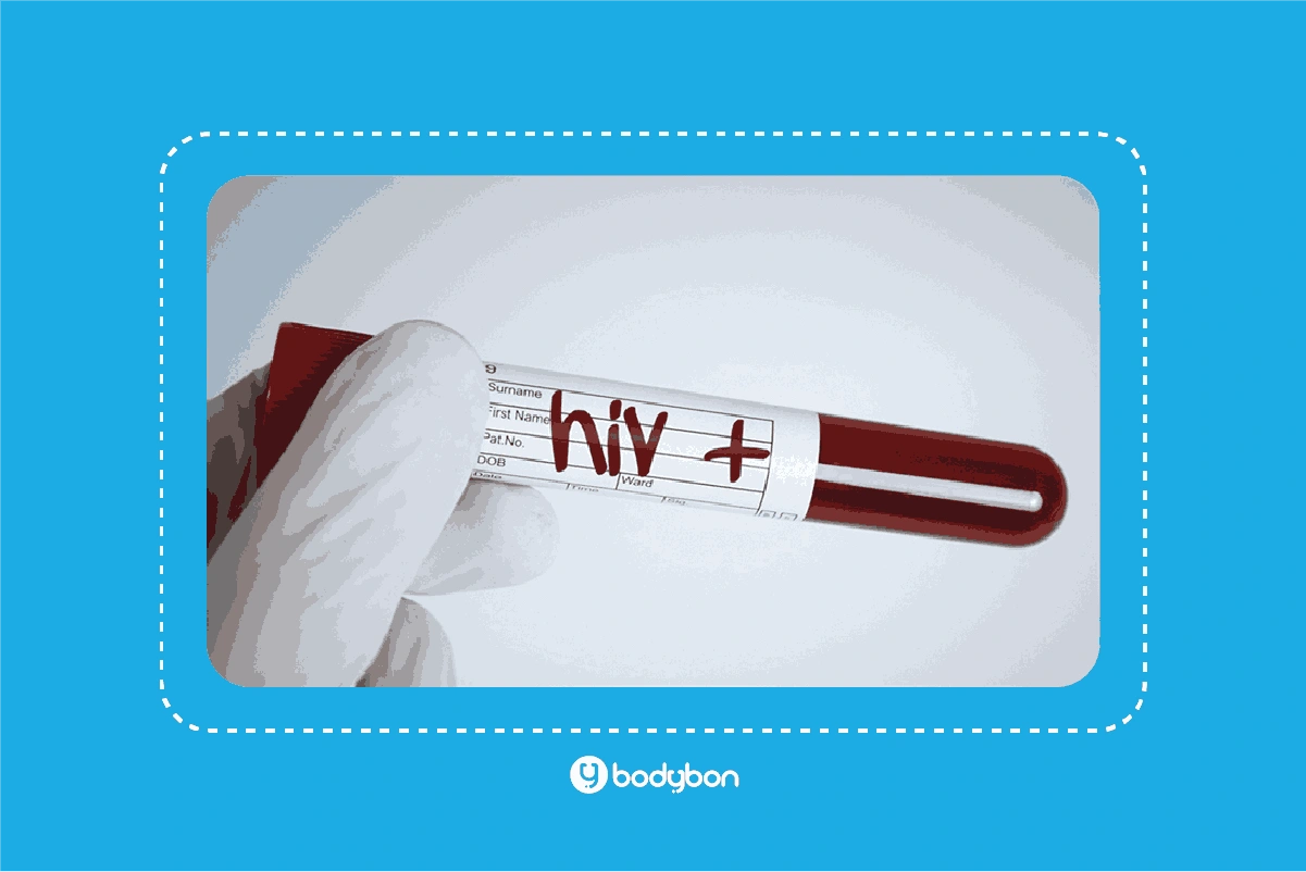 آزمایش HIV چیست و چرا انجام آن اهمیت دارد؟ 1 آزمایش ایدز برای تشخیص ویروس HIV قبل از رسیدن به مرحله پیشرفته توسط پزشک درخواست میشود.