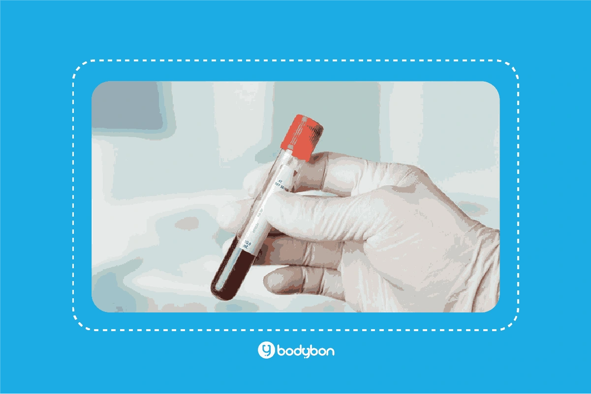 آزمایش هورمونی چیست؟ | تفسیر آزمایش هورمونی 1 تفسیر آزمایش هورمونی راهکاری برای تشخیص بسیاری از اختلالات و بیماریهاست.