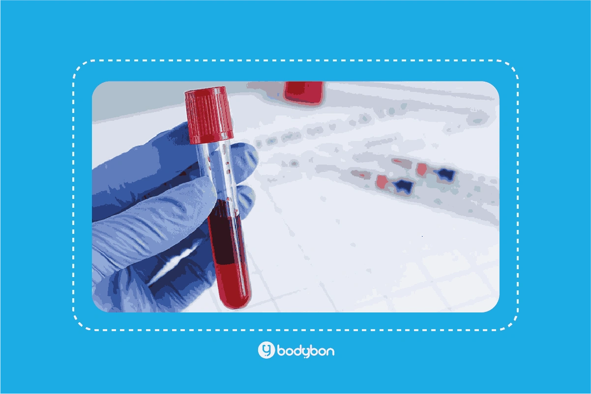 آزمایش هورمونی چیست؟ | تفسیر آزمایش هورمونی 2 آزمایش هورمونی شامل آزمایش هورمونهای جنسی و آزمایش هورمونهای نیروئیدی است.