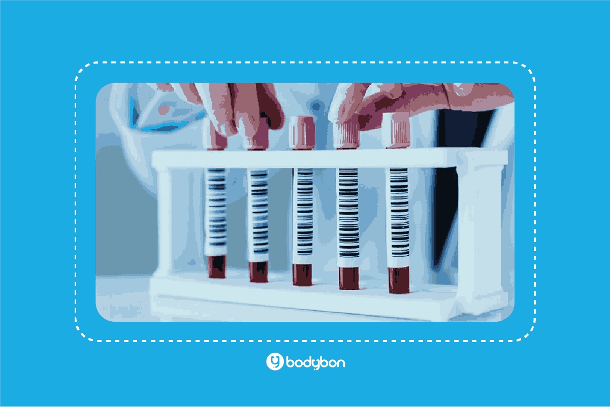 آزمایش MCH بخش مهمی از آزمایش شمارش کامل خون است