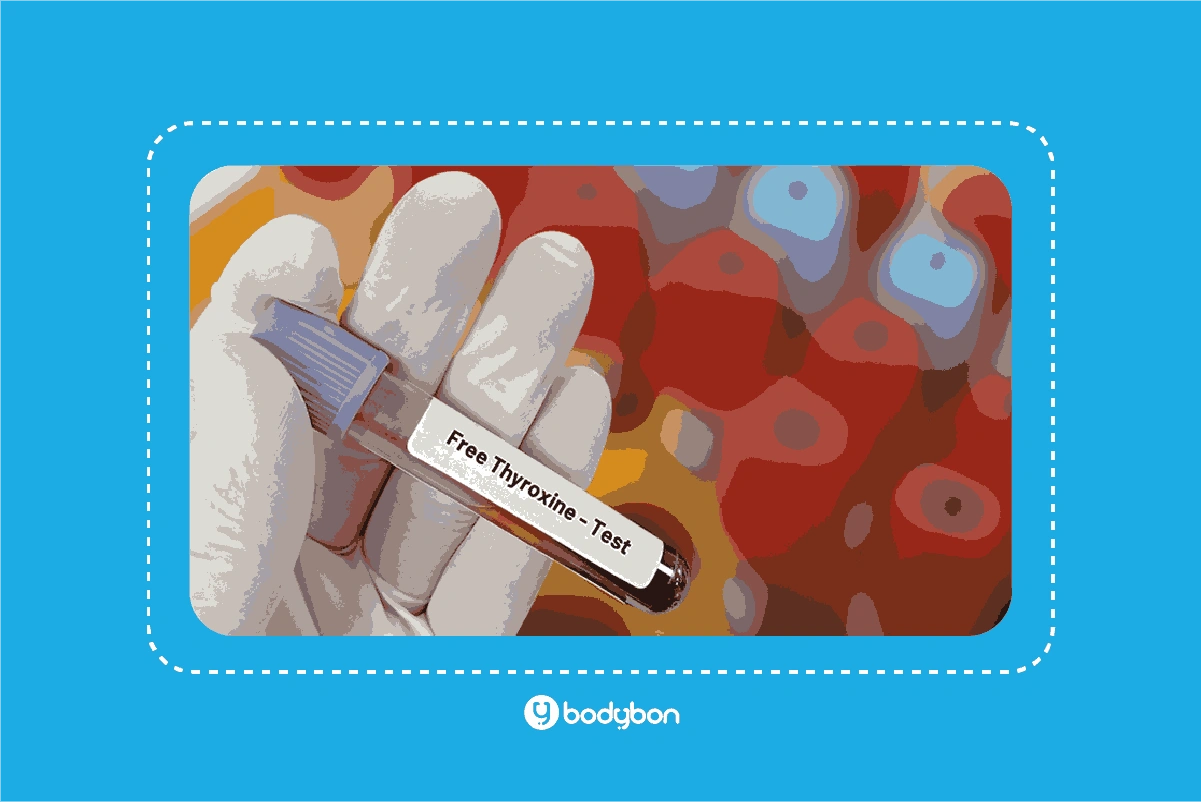آزمایش T4 چیست و چه کاربردی دارد؟ 2 نکات آمادگی ضروری قبل از آزمایش تیروکسین توتال