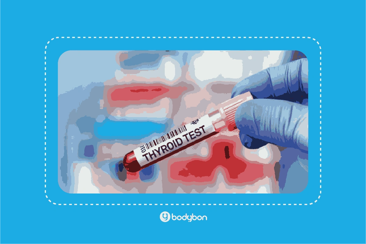 آزمایش T4 چیست و چه کاربردی دارد؟ 3 کاهش T4 در آزمایش خون نشانگر کمکاری تیروئید است.