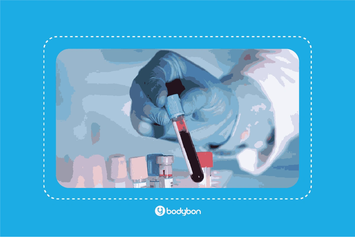 آزمایش T4 چیست و چه کاربردی دارد؟ 1 آزمایش T4 برای بررسی سلامت غذه تیروئید انجام میشود.