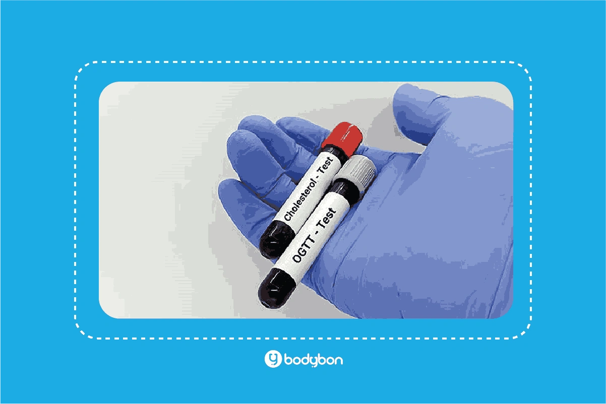 آزمایش OGTT و HbA1c و FBS برخی از انواع آزمایش قند هستند.