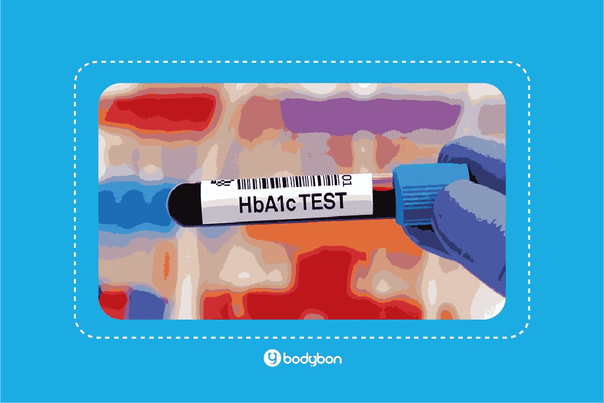 آزمایش HbA1C چیست؟ تفسیر HbA1C در آزمایش خون 2 تفسیر HbA1C در آزمایش خون چگونه انجام میشود؟