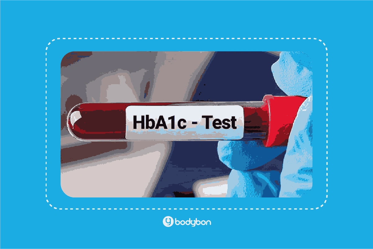 آزمایش HbA1C چیست؟ تفسیر HbA1C در آزمایش خون 3 عوامل موثر بر جواب آزمایش HbA1C چیست؟