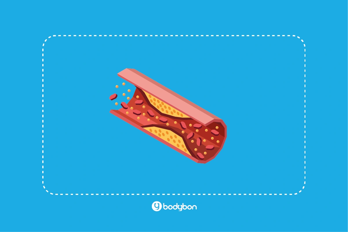 تفسیر کسترول در آزمایش خون به بررسی قلب و عروق کمک میکند.