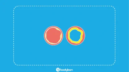 آزمایش کلسترول چیست؟ | تفسیر کلسترول در آزمایش خون