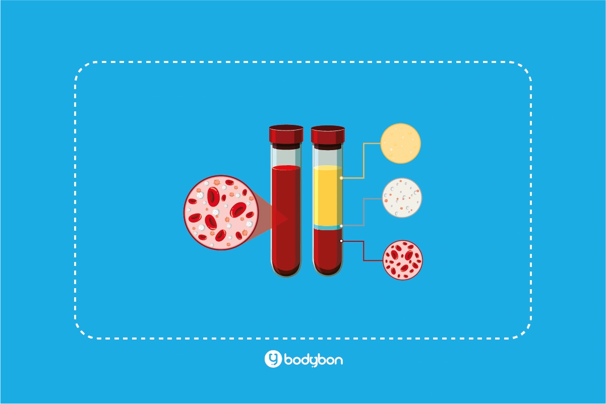 تفسیر آزمایش تری گلیسیرید چگونه انجام میشود؟