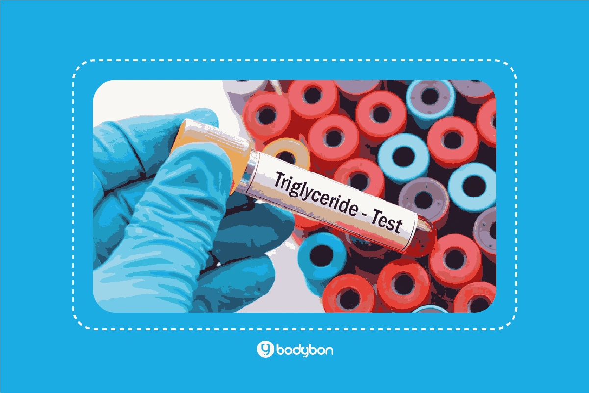 بالا بودن TG در آزمایش خون با برخی علائم همراه است.