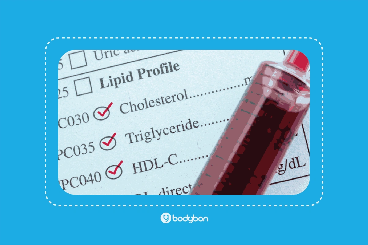 تفسیر TG در آزمایش خون به ما در حفظ سلامت قلب و عروق کمک میکند.