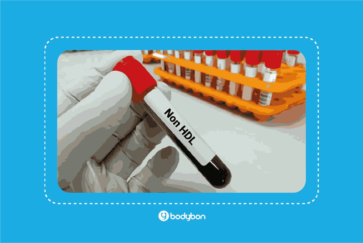 پایین بودن HDL در آزمایش خون می‌تواند نشانه‌ای از ریسک بالای بیماری قلبی باشد.