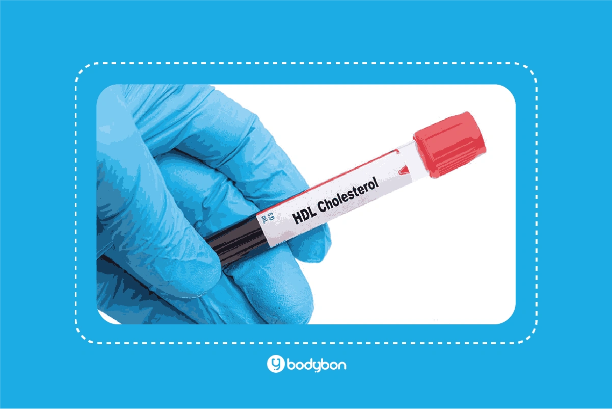 آزمایش HDL یا HDL در آزمایش خون، بخشی از پنل لیپید است که به کلسترول خوب معروف است.