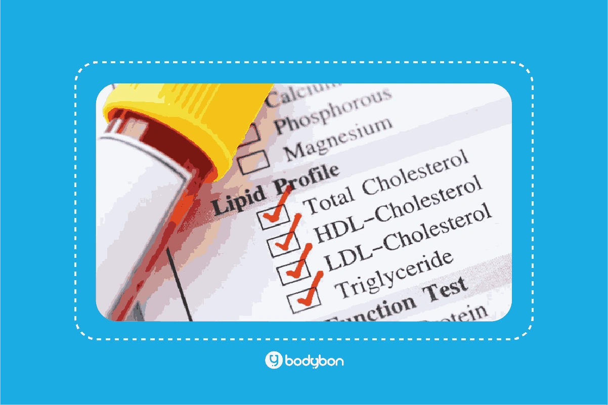 نتیجه LDL در آزمایش خون یا آزمایش LDL در کنار آزمایش HDL، کسترول و تری‌گلیسیرید ارزیابی می‌شود.