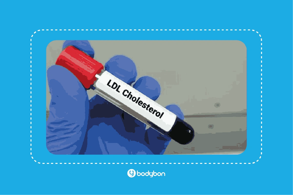 مقدار بالای LDL در آزمایش خون می‌تواند نشانه ریسک بالای بیماری قبلی باشد.