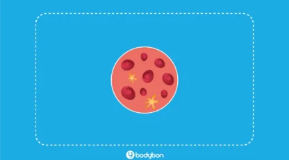 LDL در آزمایش خون چیست؟ تفسیر آزمایش LDL