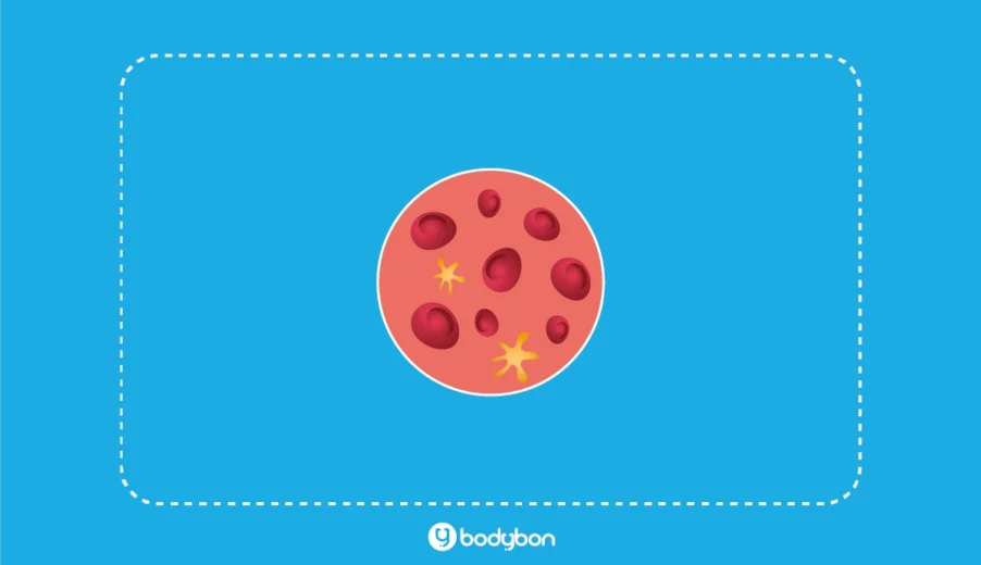 LDL در آزمایش خون چیست؟ تفسیر آزمایش LDL