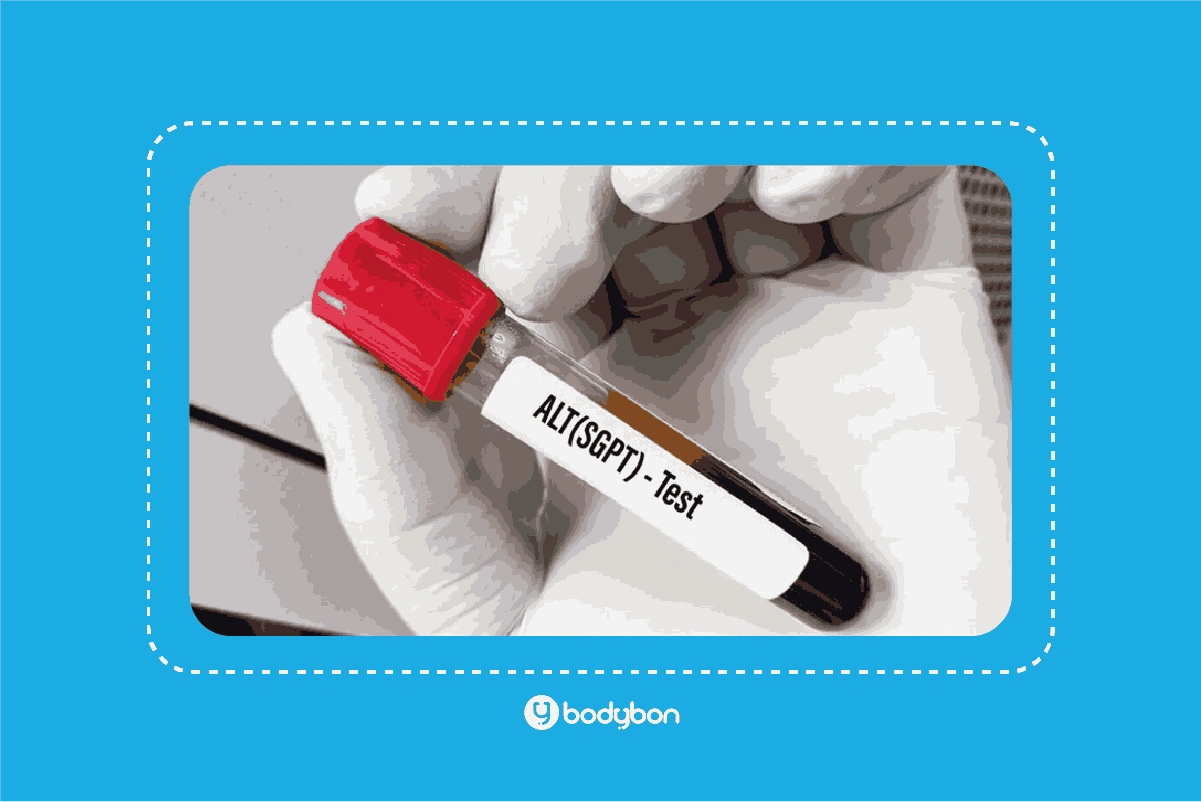 مقدار ALT در آزمایش خون یا آزمایش ALT یا SGPT خون برای بررسی عملکرد کبد انجام می‌شود.