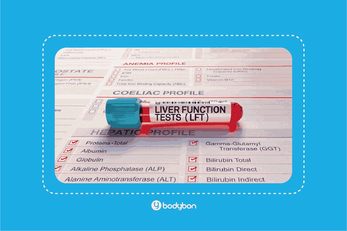 آزمایش عملکرد کبد برای افراد مبتلا به چاقی، دیابت، سندرم متابولیک، مصرف‌کنندگان الکل و افراد مبتلا به هپاتیت یا دارای سابقه خانوادگی بیماری‌های کبدی ضروری است.